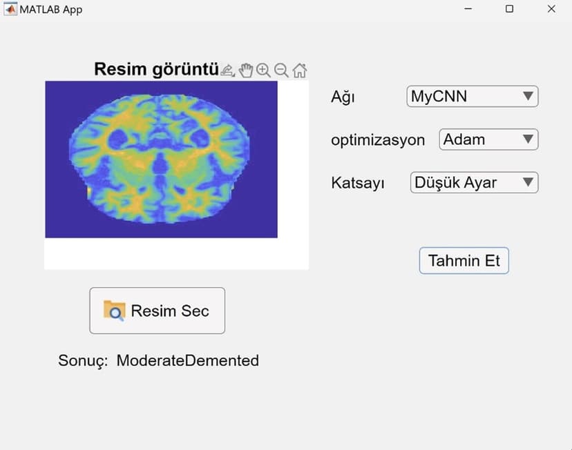 Enhancing Disease Diagnosis with Deep Learning: CNN and MobileNet for MRI Image Classification